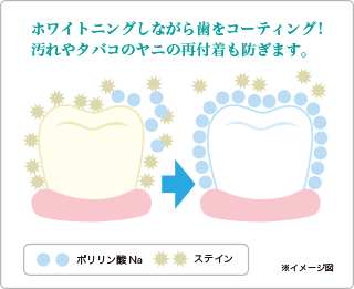 ポリリンプラチナホワイトニングとは